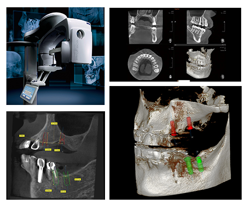 歯科用CT（PLANMECA ProMax 3D）の診断が可能になりました